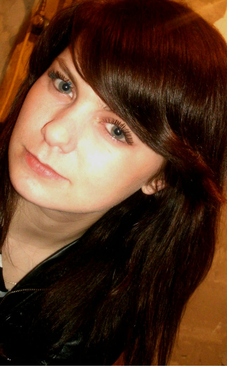 Анна Швец | Синяк