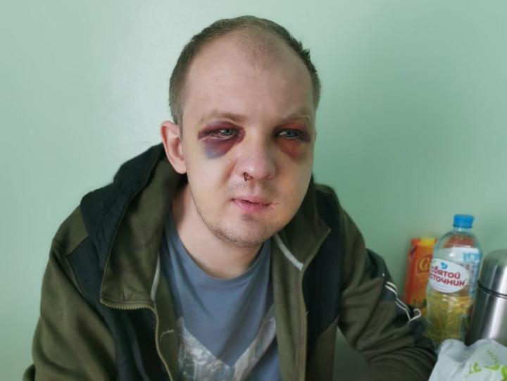 Избитому ОМОНом таксисту из Гродно должны были вынести приговор за насилие над м...