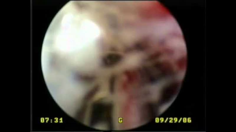 Videootoscopy in a dog, chronic